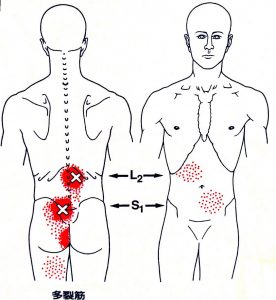 Trigger point for multifidus muscle